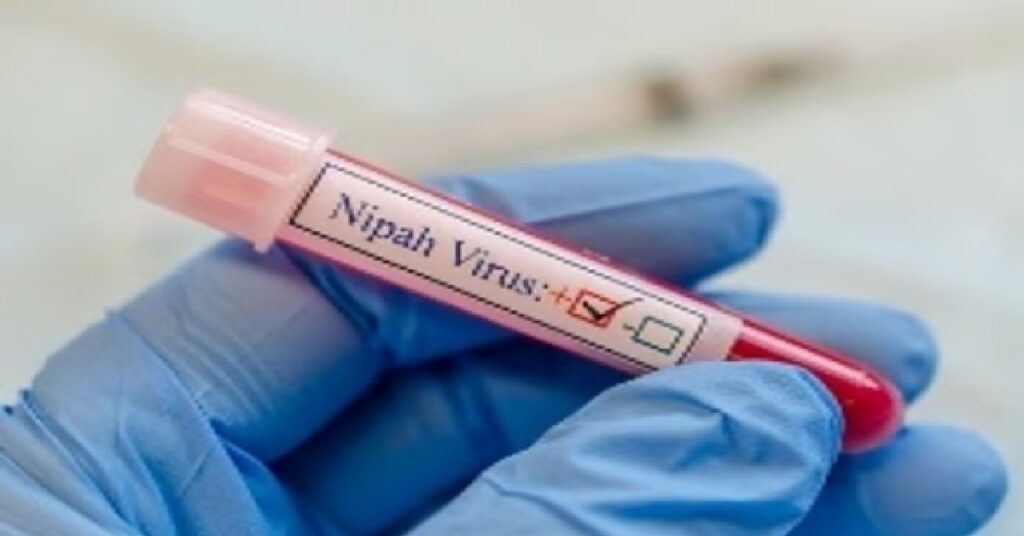 Nipah virus outbreak in India : ഇന്ത്യയിൽ നിപ വൈറസ് ബാധ: ഏഷ്യൻ വിമാനത്താവളങ്ങളിൽ അതീവ ജാഗ്രത, യാത്രക്കാരുടെ പരിശോധന കർശനമാക്കി 1 NIPA